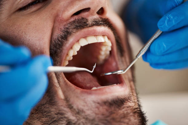 Best Dental Fillings (Composite and Amalgam)  in Lawrence, MA